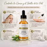 V-SEBOCONTROL SERUM 30ML PIEL GRASA