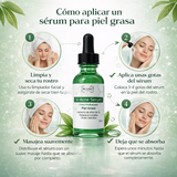 V-ACNE SERUM 30ML PIEL GRASA CON ACNE